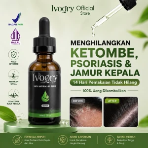 Serum Anti Ketombe Ampuh